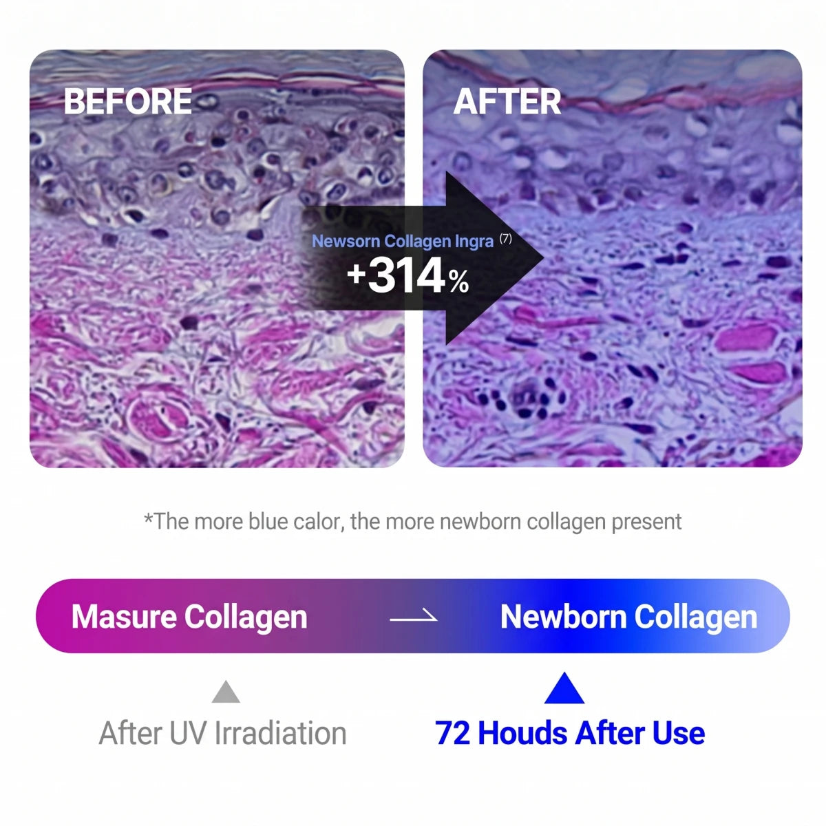 Centellian24 brand infographic comparing before and after skin collagen images
