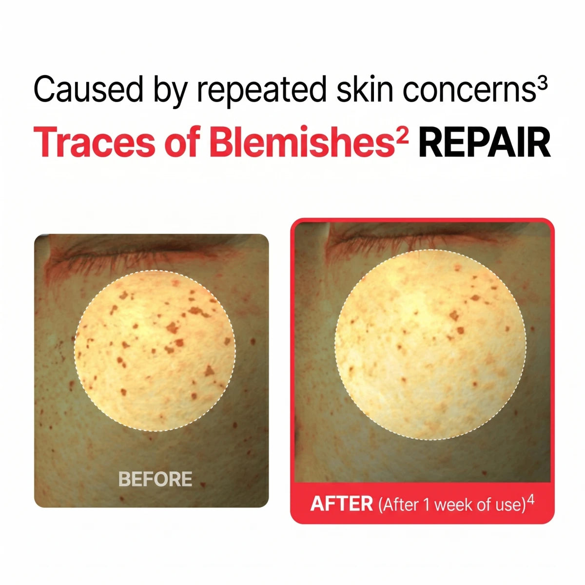 Centellian24 brand infographic with before and after close-up photos of skin